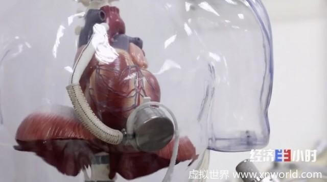 山东首例人工心脏植入患者出院,需每天充电【高科技】