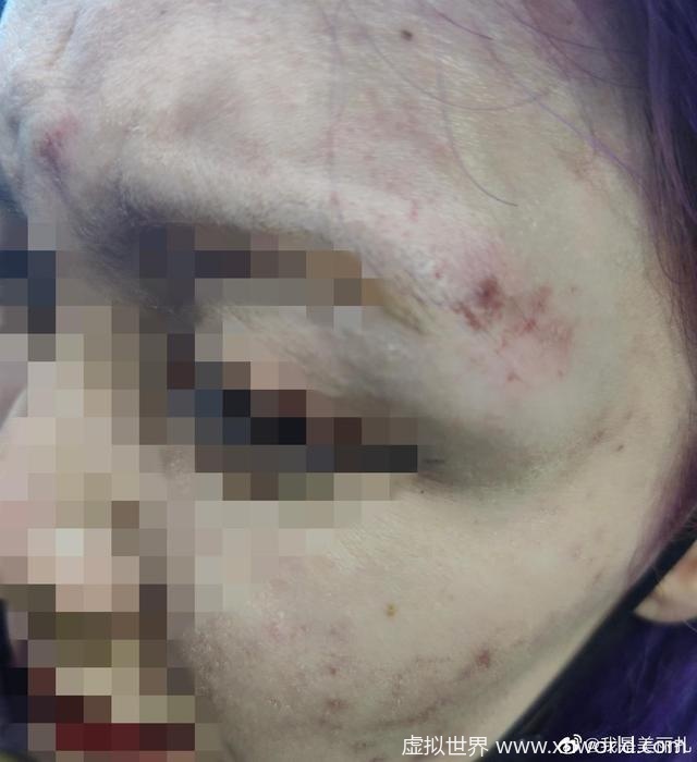 山东泰山俱乐部回应球员被曝殴打女生【网友称:必须严惩】